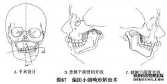 下巴的右端是什么？